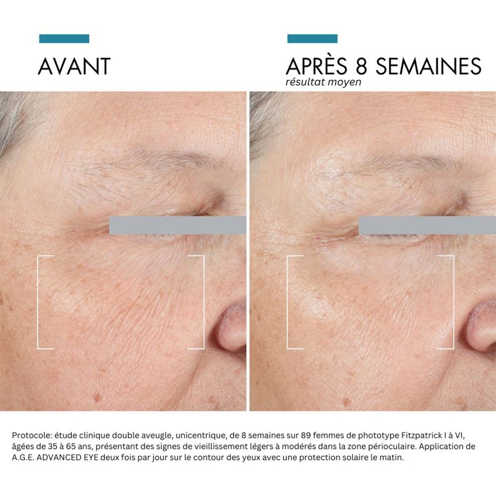 Comparaison avant-après. Réduction des rides après 8 semaines.