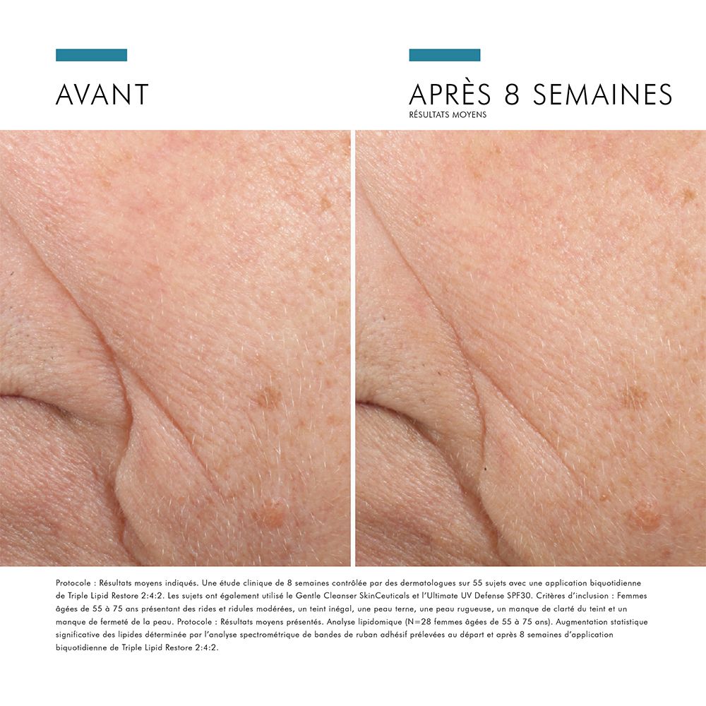 SkinCeuticals Triple Lipid Restore 2:4:2