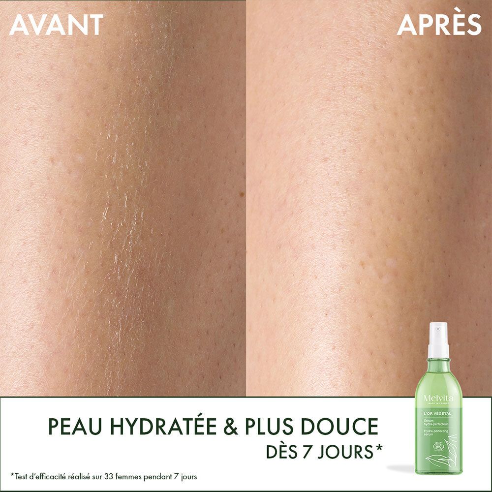 Comparaison avant-après de la peau. Texte : Peau hydratée & plus douce dès 7 jours. Bouteille en arrière-plan.