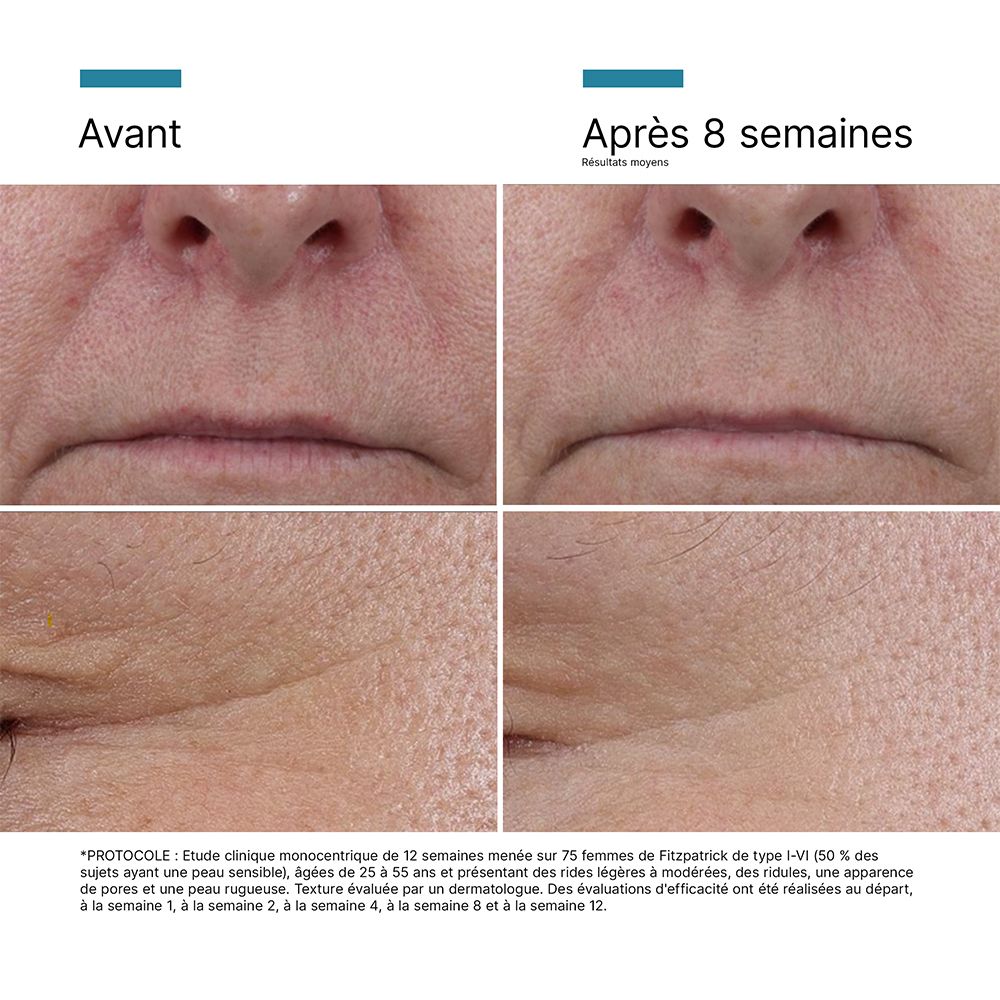 Skinceuticals P-TIOX Anti-agingserum om rimpels te corrigeren