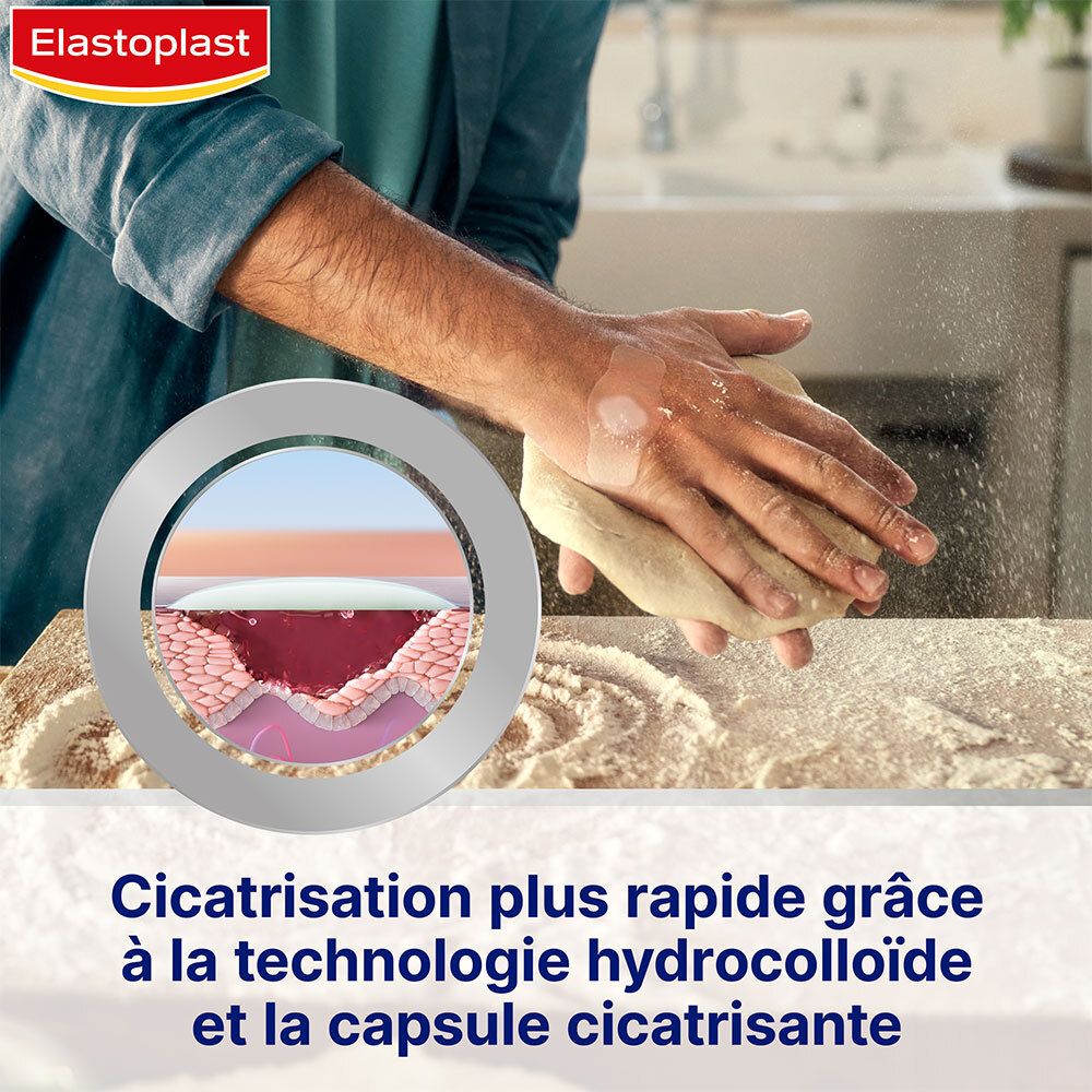 Illustratie van wondgenezing. Tekst: Sneller genezen dankzij hydrocolloïd technologie en genezingscapsule.