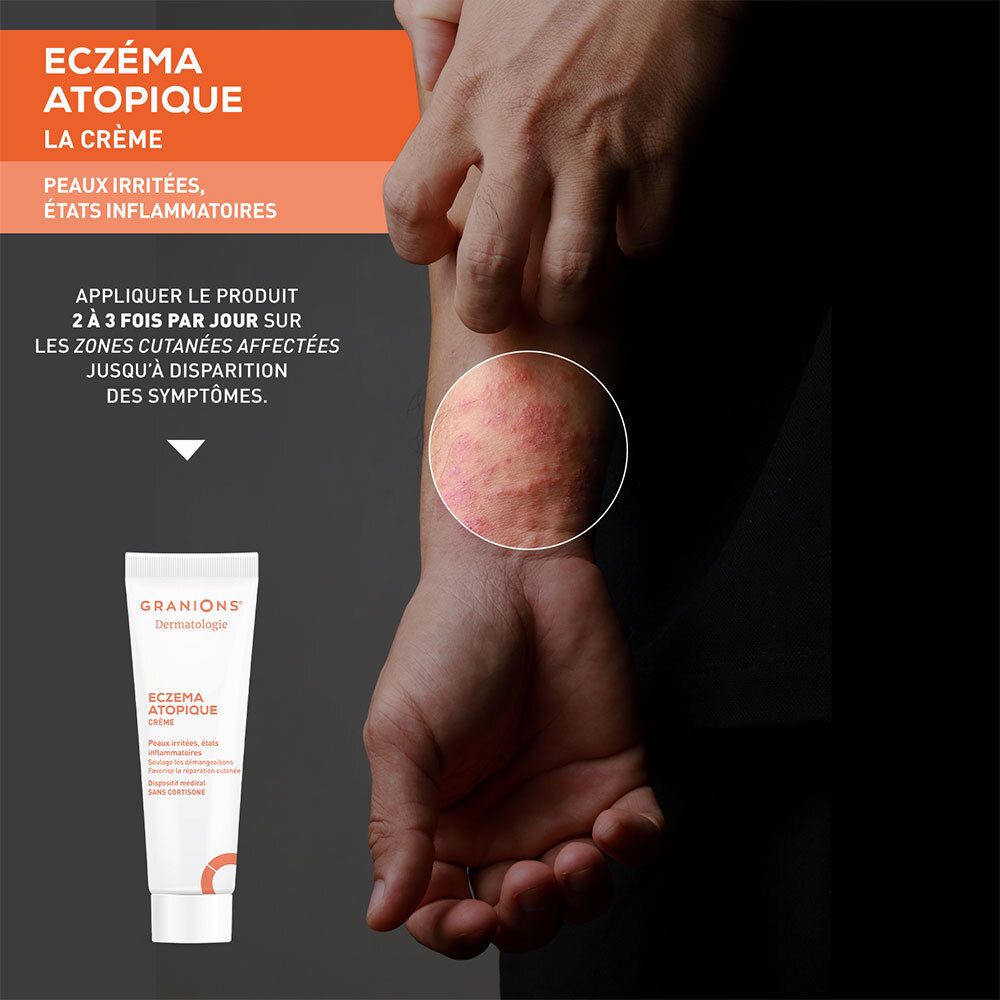 Persoon toont arm met eczeem. Crèmetube ernaast. Opschrift: Eczema Atopique. Medisch hulpmiddel.