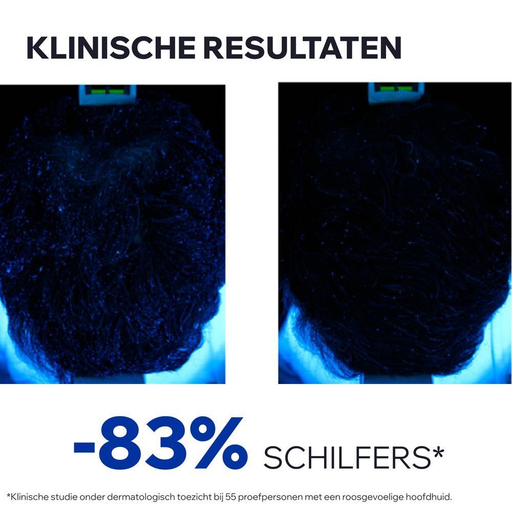 Klinische resultaten: hoofdhuid voor en na behandeling. Tekst: -83% SCHILFERS.