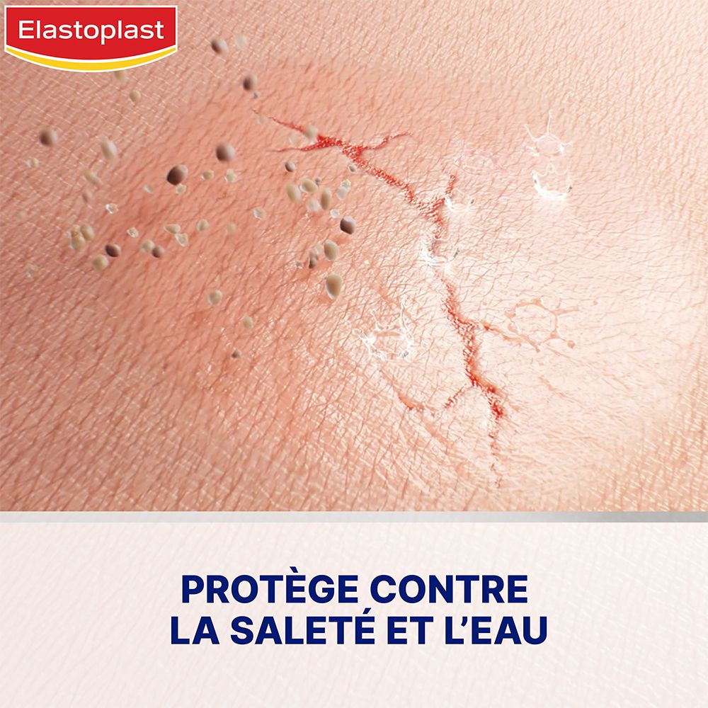 Huid met scheuren. Tekst: Beschermt tegen vuil en water. Elastoplast Pansement Liquide Concentré.