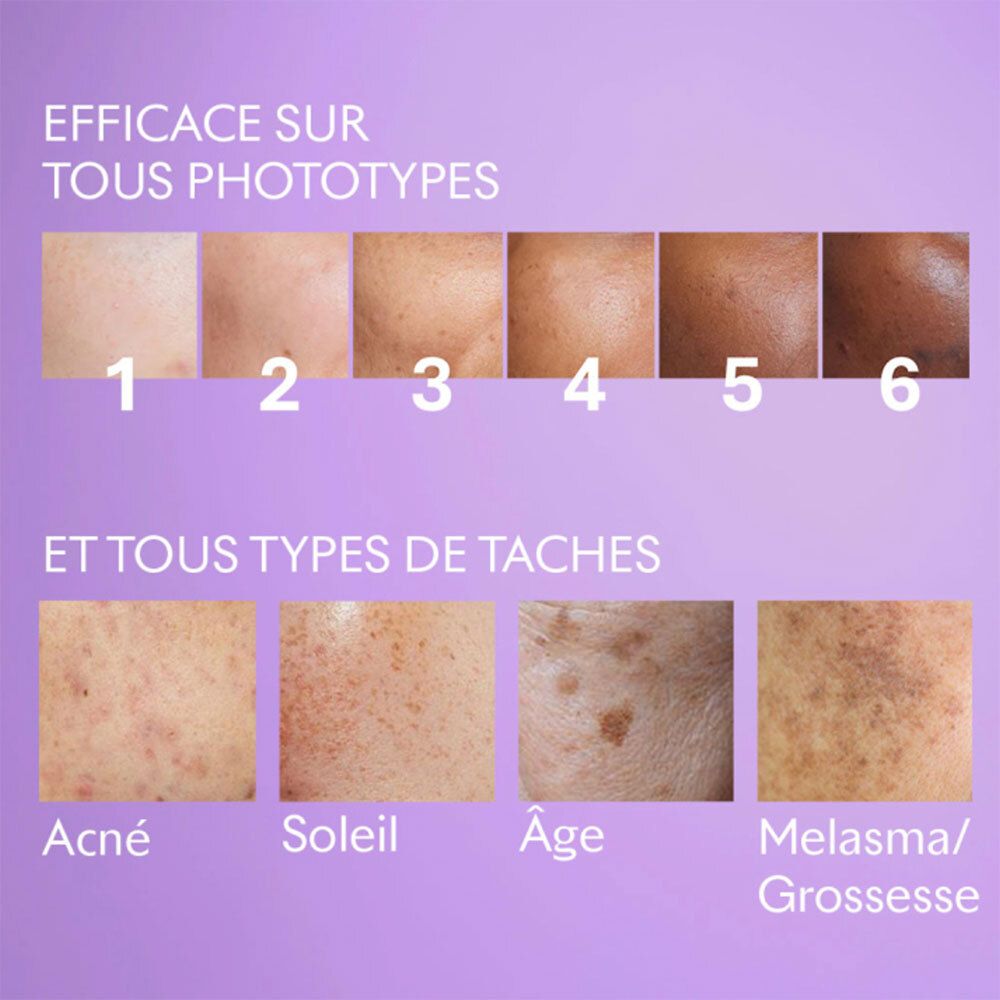 Tableau des types de peau. Texte: Efficace sur tous les types de peau et de taches: Acné, Soleil, Âge, Melasma.