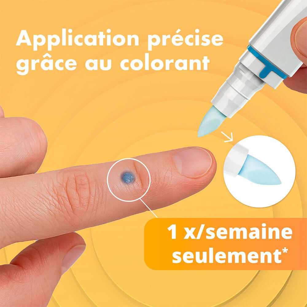 Application précise d'un liquide coloré sur une verrue au doigt.