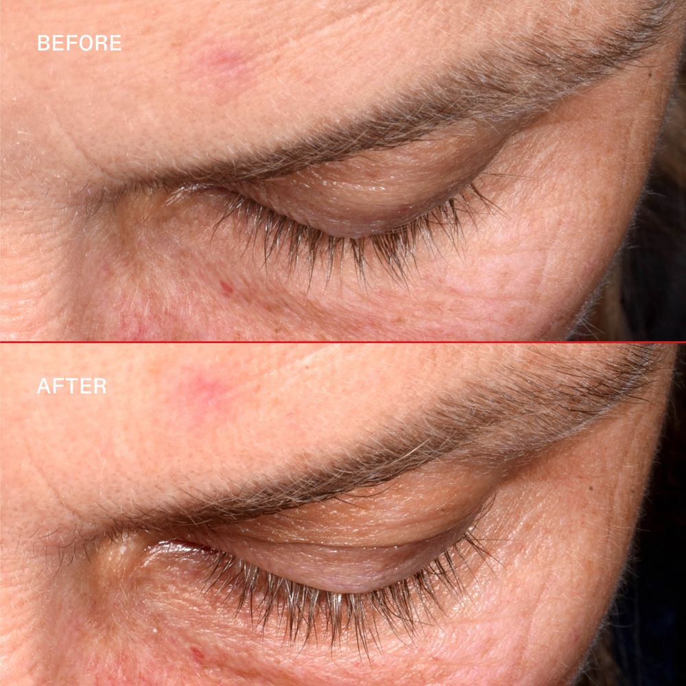 Deux gros plans sur les yeux. En haut : Avant. En bas : Après. Les cils sont plus longs.