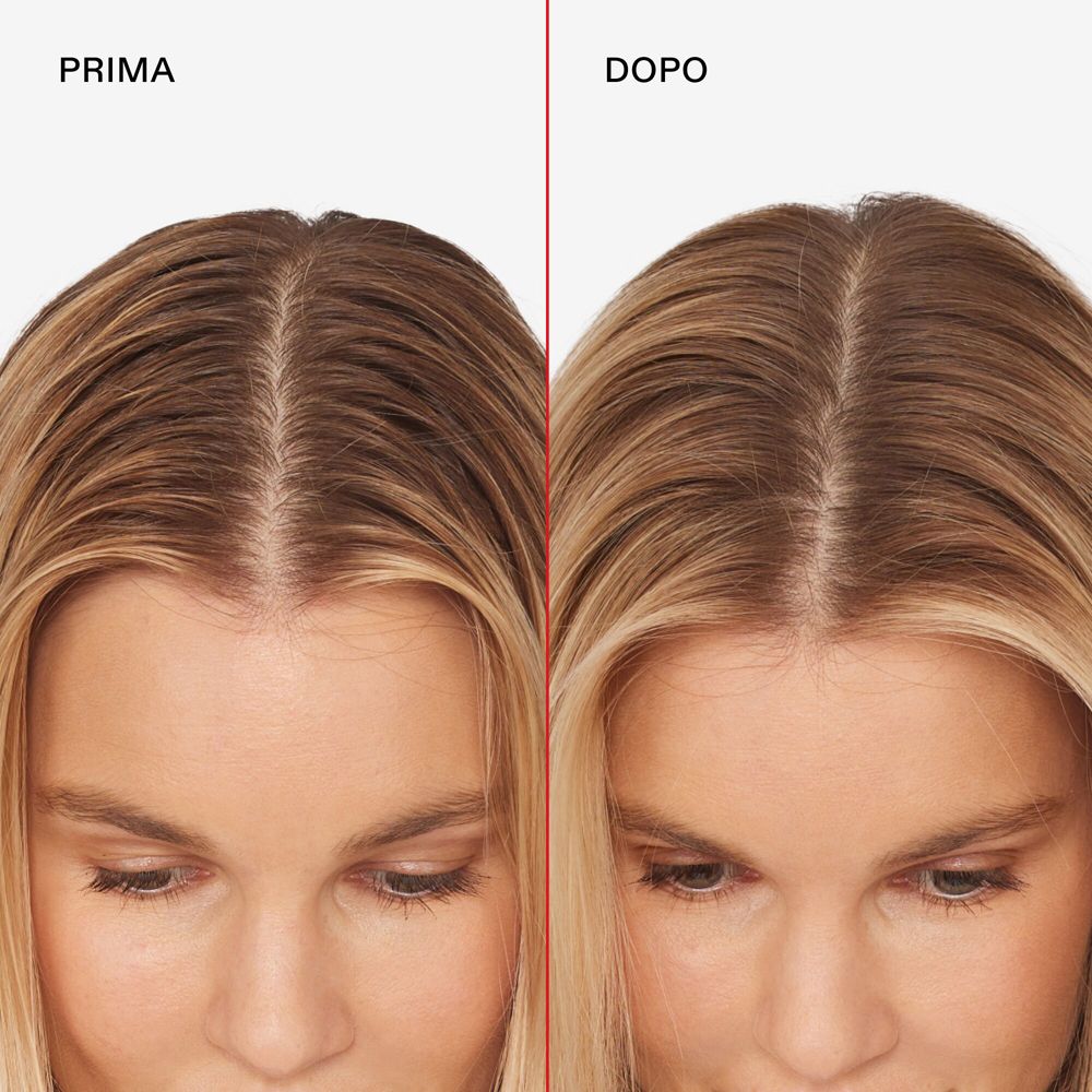 Voor-en-na vergelijking van de haarlijn van een vrouw met blond haar.