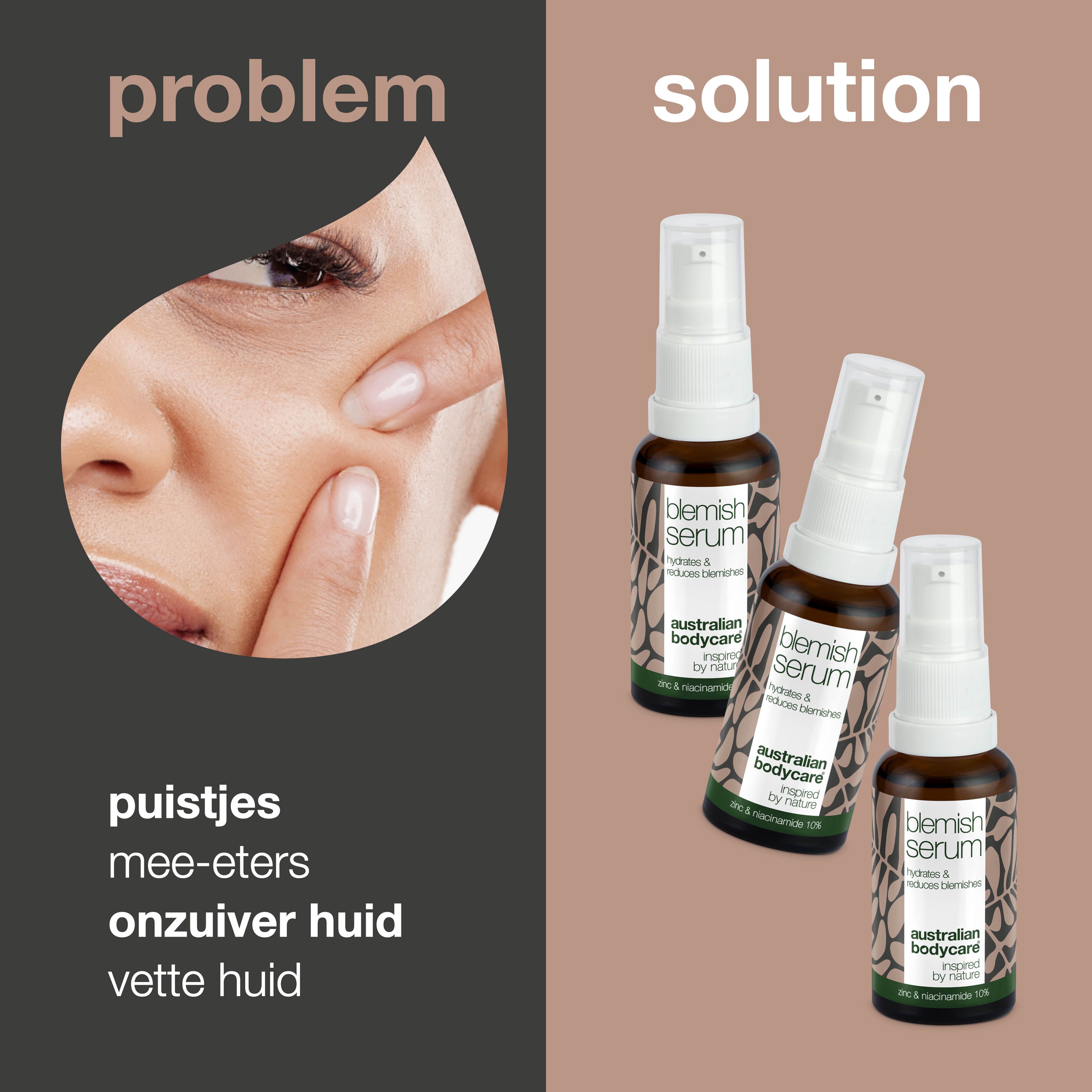 Probleem-oplossing presentatie. Gezicht met puistjes, naast drie serumflessen. Tekst: puistjes, vette huid.