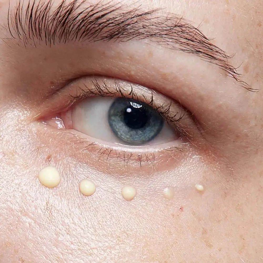 Oog met crèmedruppels. Lichte, ronde druppels onder het oog. Close-up.