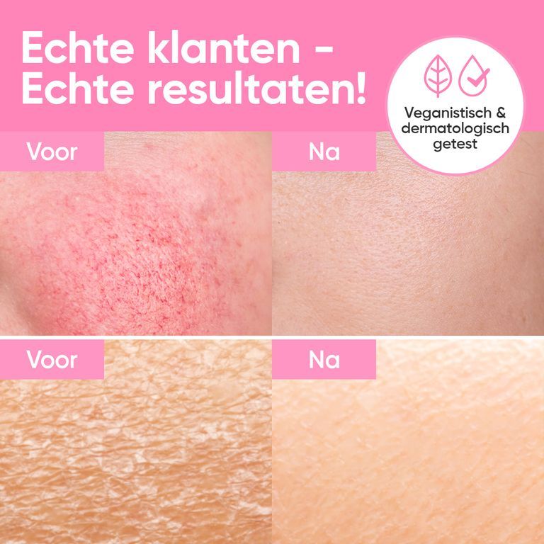 Druppelaar met serum en tekstvakken die ingrediënten en hun voordelen opsommen.