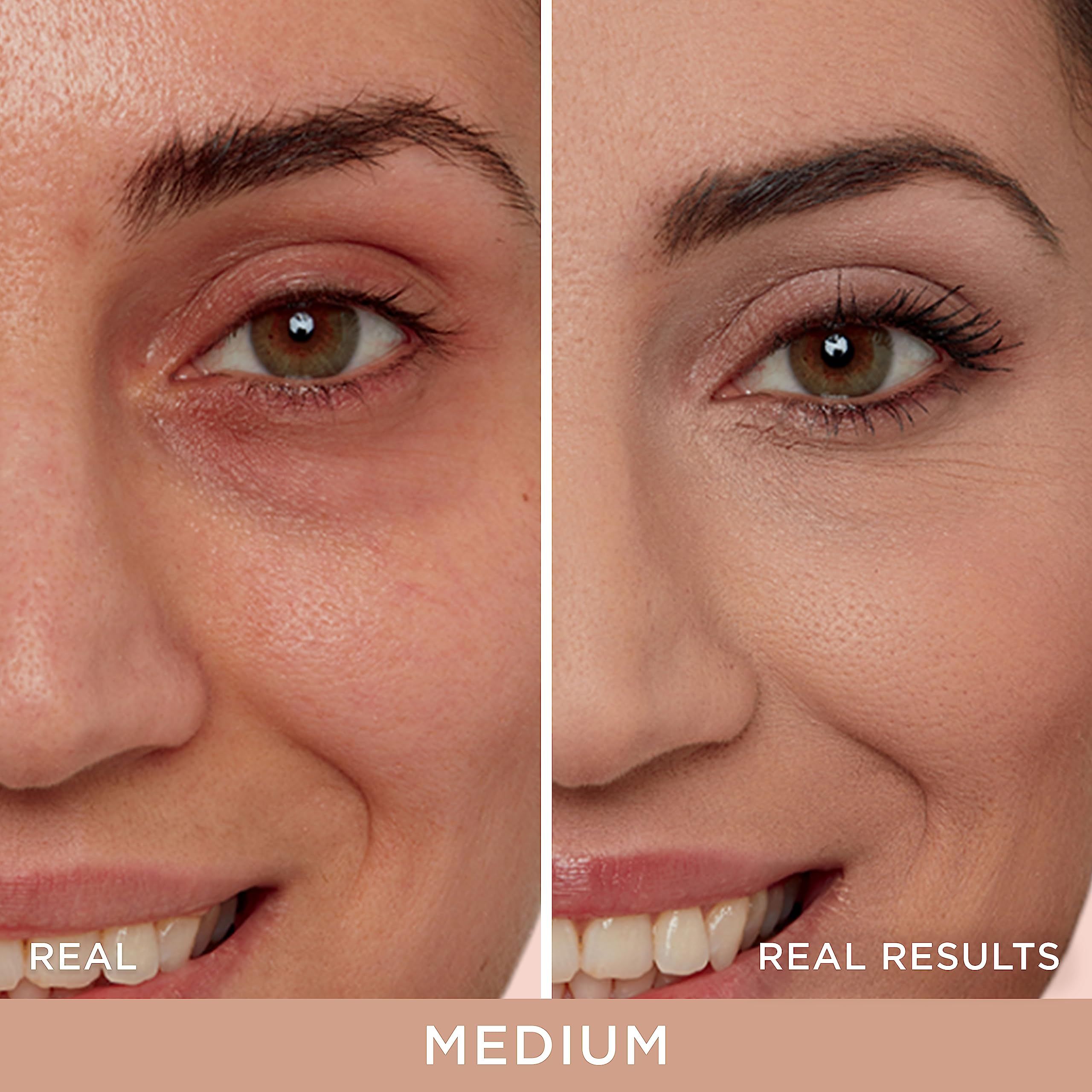 Comparaison avant-après d'un visage. Zones: contour des yeux. Texte: REAL RESULTS. Teinte: MEDIUM.