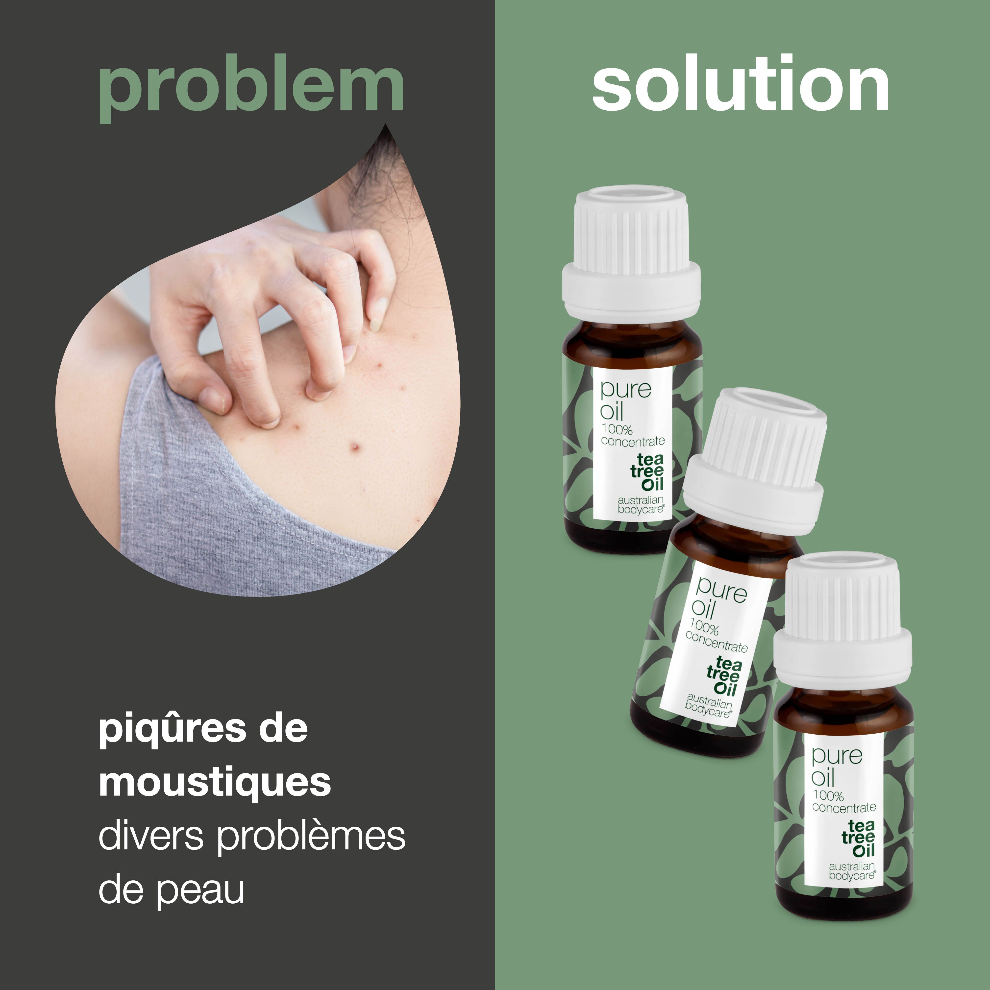 Problème et solution. Flacons d'huile d'arbre à thé. Inscription : Pure Oil, 100% Concentrate, Tea Tree Oil. Texte : piqûres de moustiques, problèmes de peau.