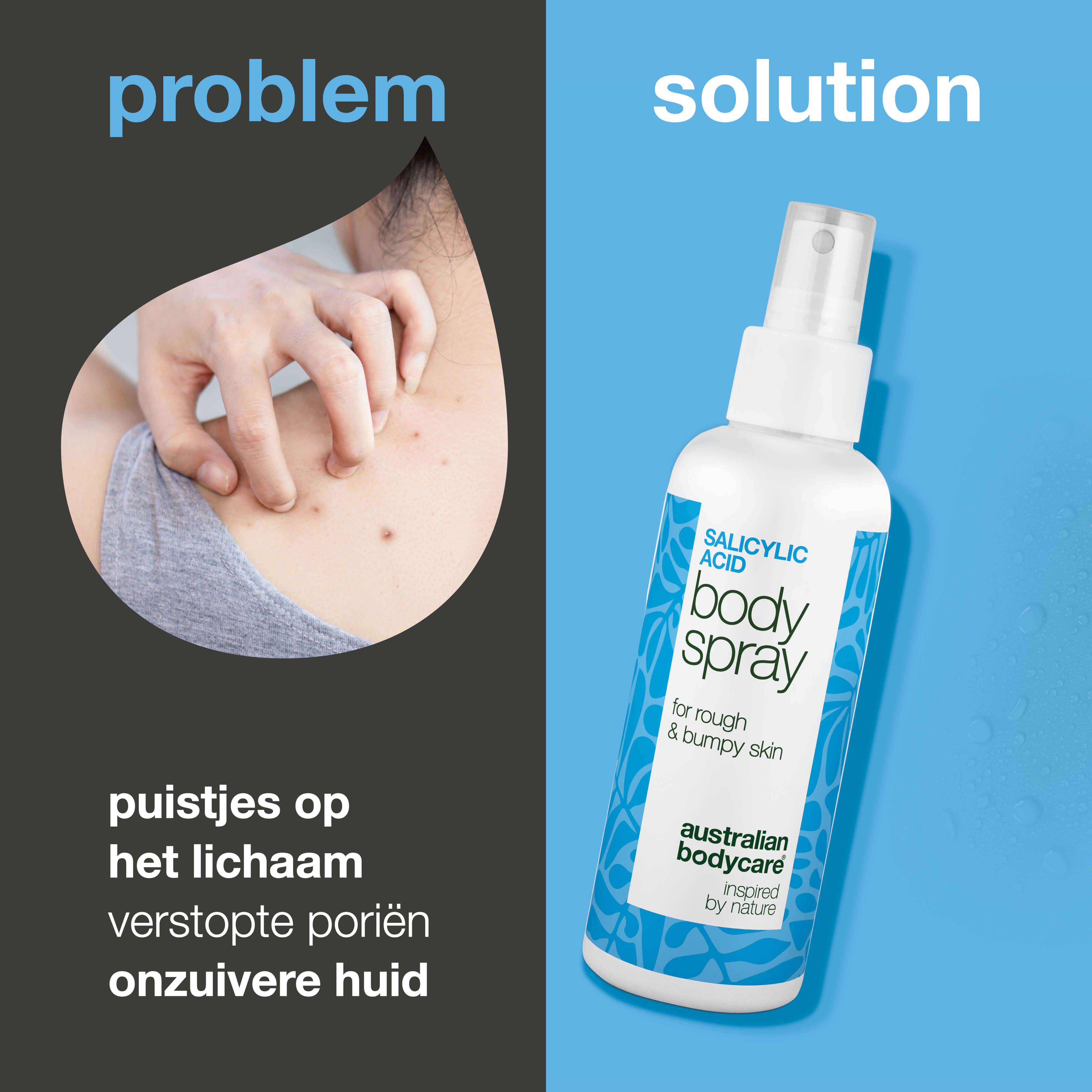 Vergelijking: probleem (huid met puistjes) en oplossing (spray). Sprayfles met tekst: Salicylic Acid Body Spray. Merk: Australian Bodycare.