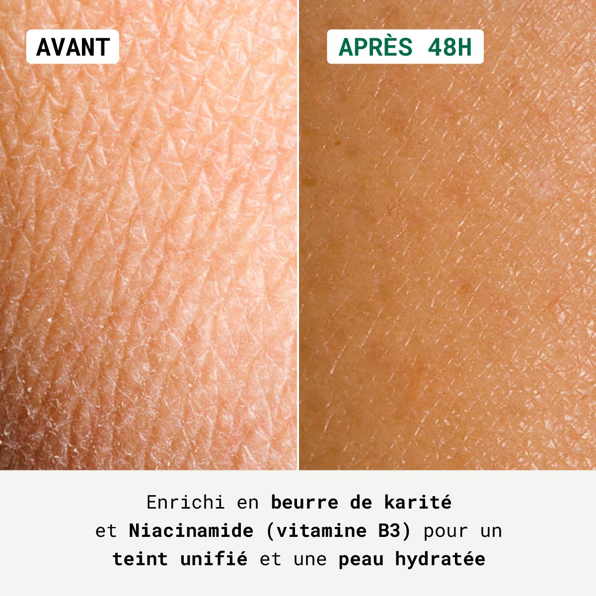 Peau avant et après 48h. Texte: Enrichi en beurre de karité et Niacinamide pour un teint unifié et hydraté.