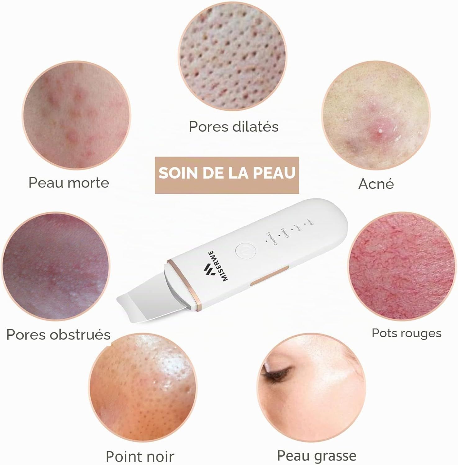 Un appareil de soin de la peau blanc avec une pointe métallique et la marque 'MISERWE'. Montre des problèmes de peau comme l'acné et les points noirs.