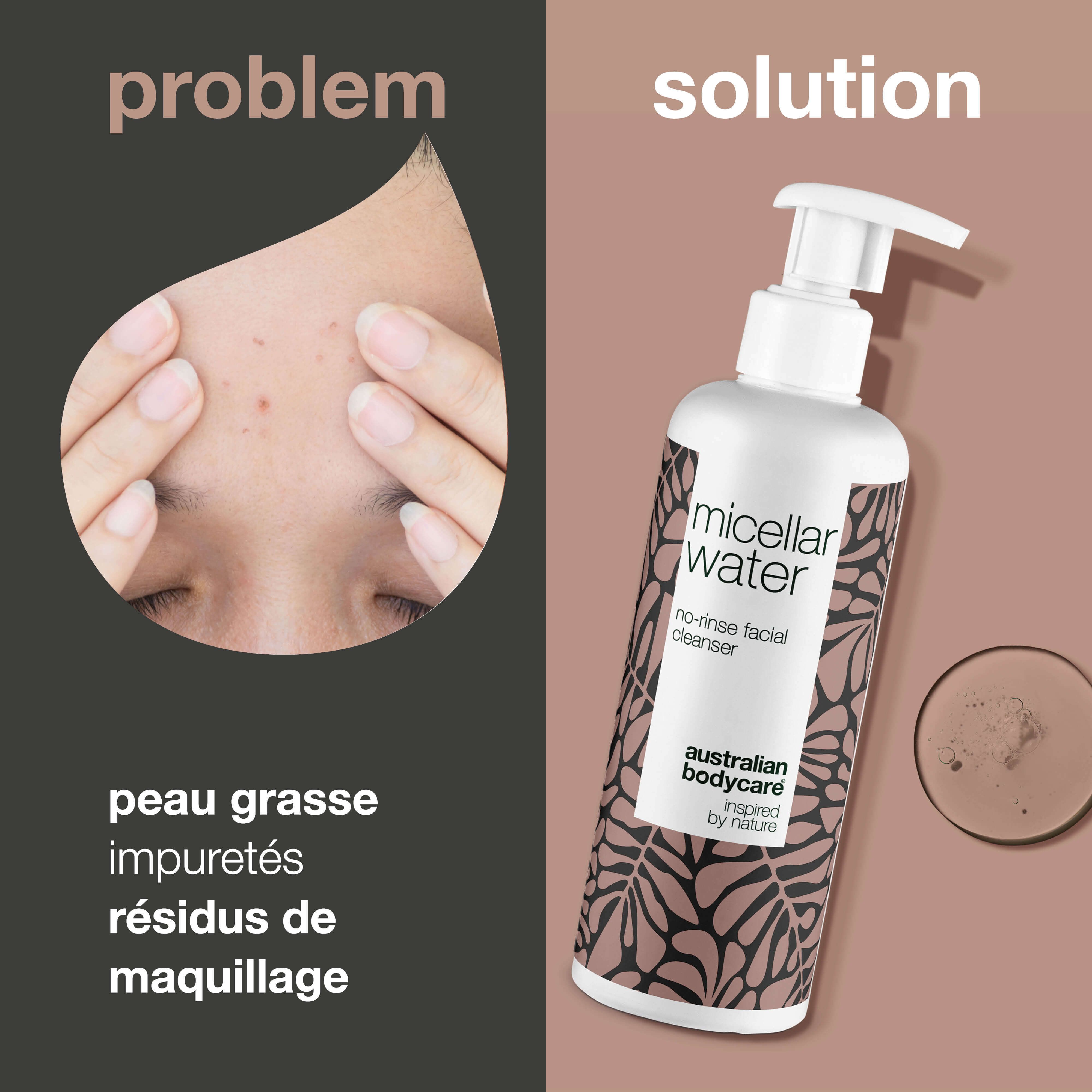 Comparaison : problèmes de peau et solution. Flacon Micellar Water. Texte : Australian Bodycare. Problème : peau grasse, impuretés, résidus de maquillage.