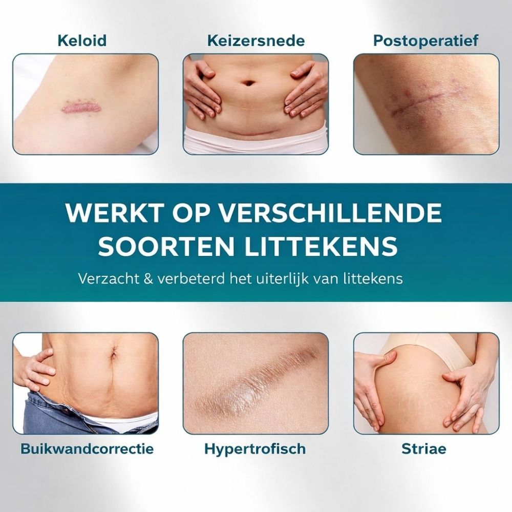 Afbeeldingen van verschillende soorten littekens: keloïd, keizersnede, postoperatief, buikwandcorrectie, hypertrofisch, striae.