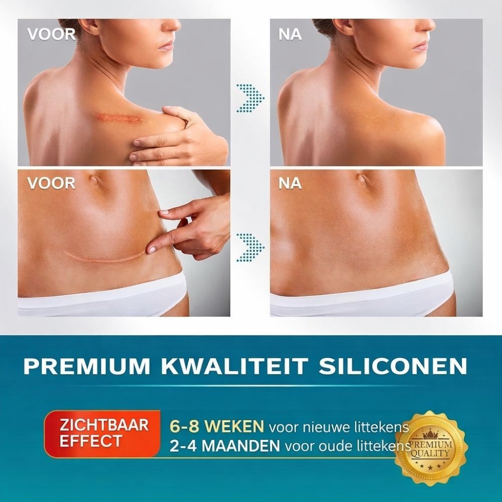 Vergelijkende afbeeldingen voor en na. Tekst: Premium siliconen voor oude en nieuwe littekens.