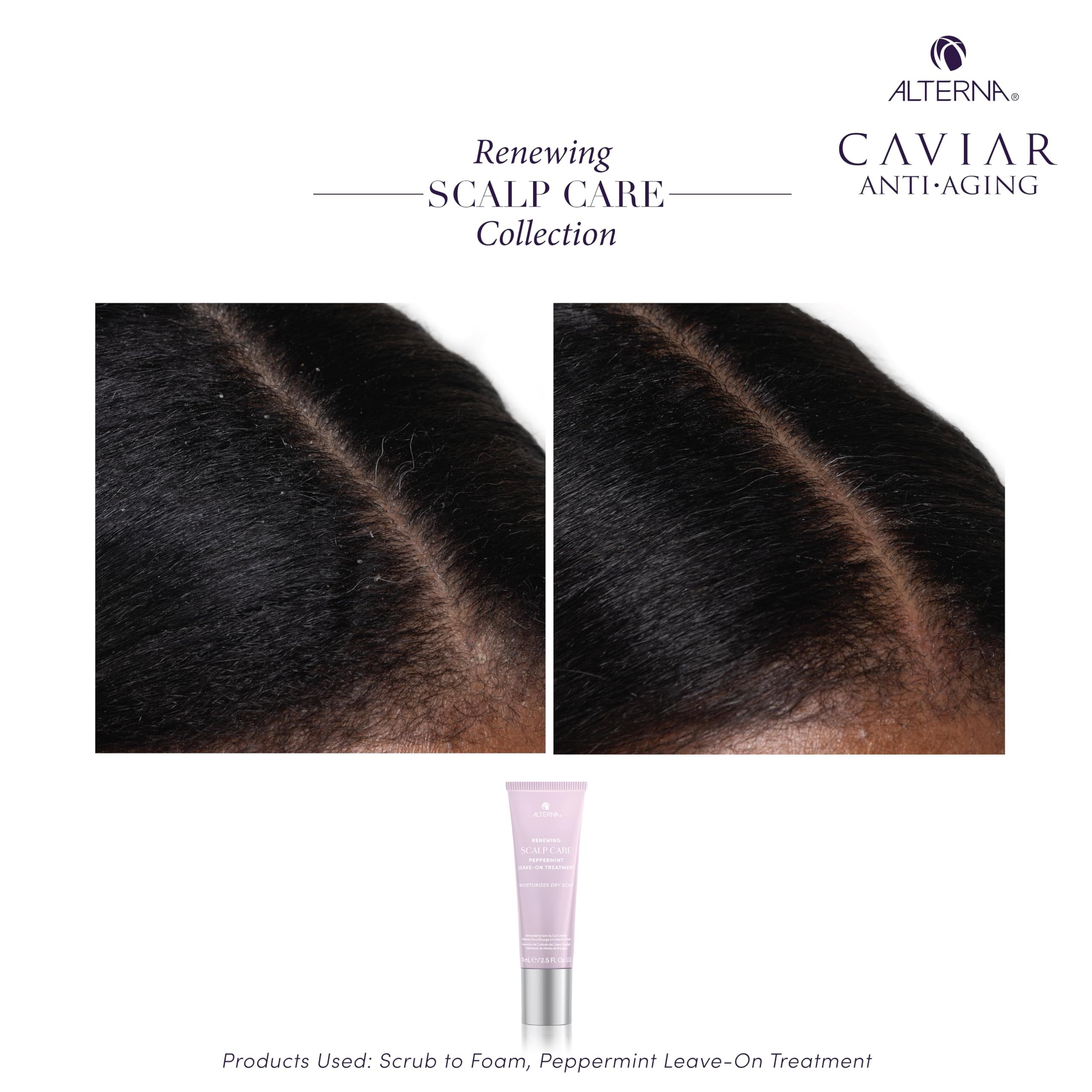 Alterna, Vernieuwende Scalp Care, Peppermint, Balances Vocht