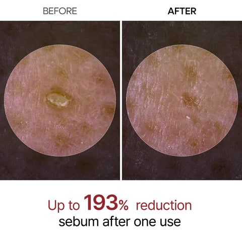 Comparaison avant-après de la texture de la peau après utilisation du peeling.