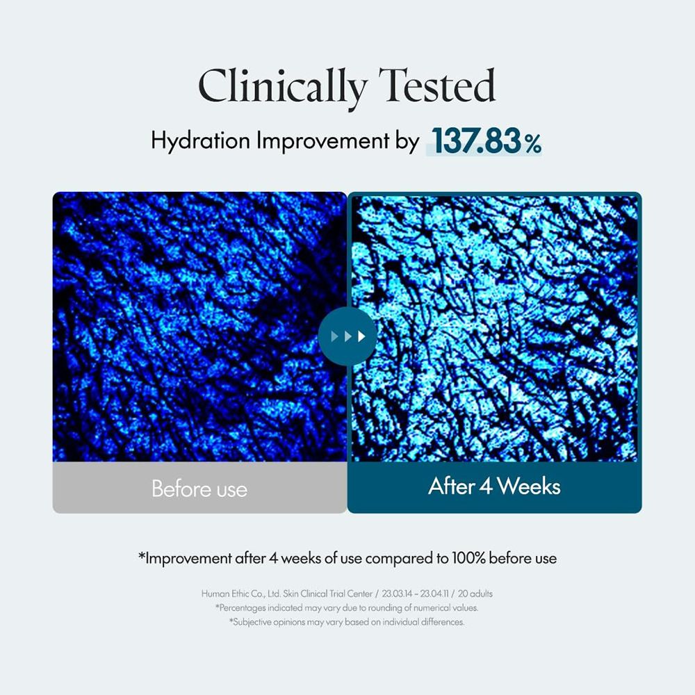 Twee blauwe beelden van huid onder de microscoop. Bijschrift: Voor gebruik en Na 4 weken. Tekst: Hydratatieverbetering met 137,83%.