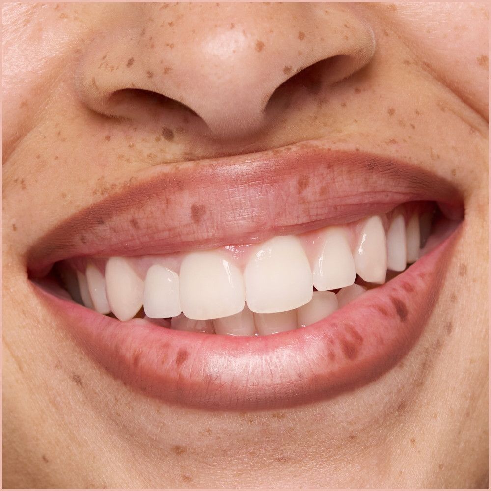 Close-up van een glimlach. Witte tanden, roze lippen met sproeten.