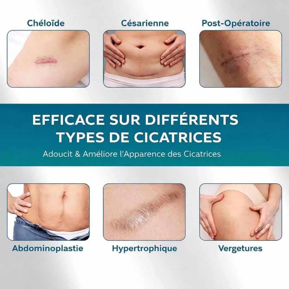 Images comparatives avant/après. Texte: Silicone de qualité supérieure pour cicatrices anciennes et nouvelles.
