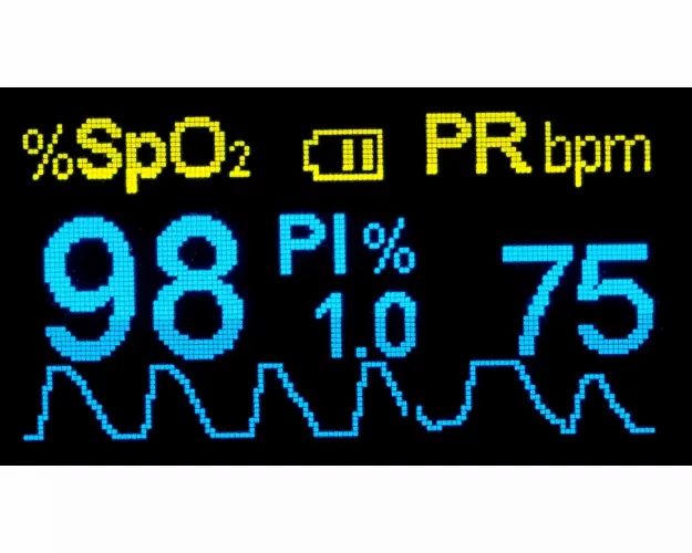 Digitale weergave van een vingerpulsoximeter met SpO2, PI en PR waarden.