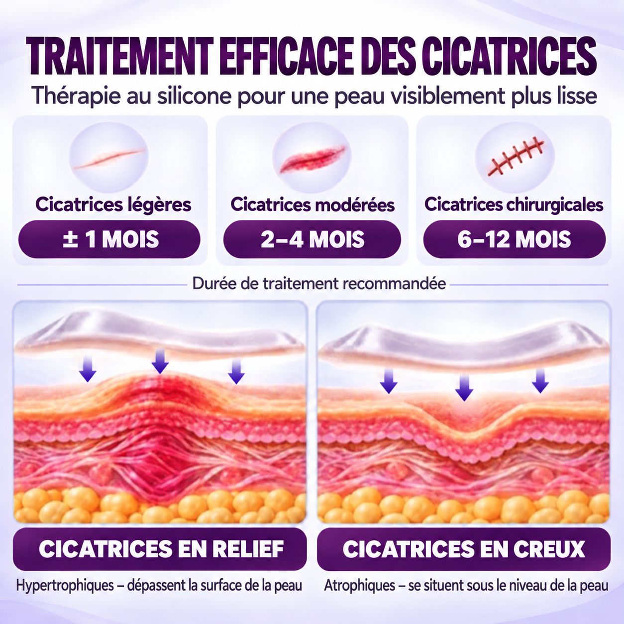 Thérapie au silicone pour cicatrices : légères, modérées, chirurgicales. Hypertrophiques vs atrophiques.