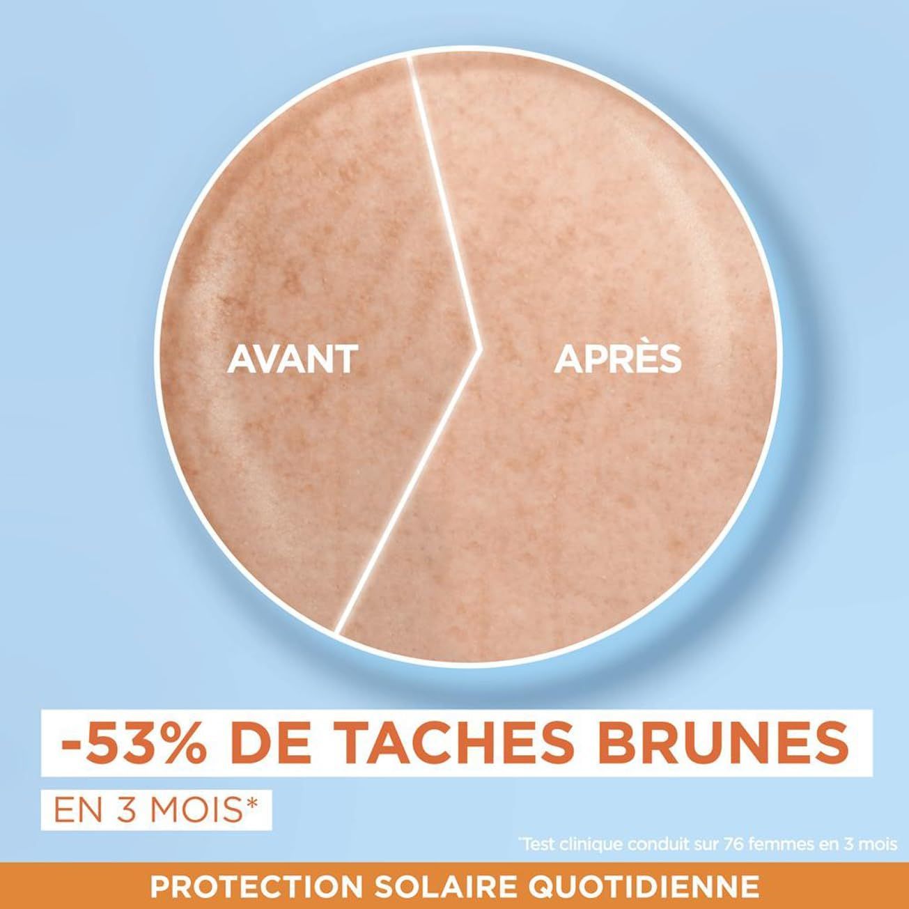 Comparaison de peau : Avant-après de la pigmentation cutanée. -53% de taches brunes en 3 mois.