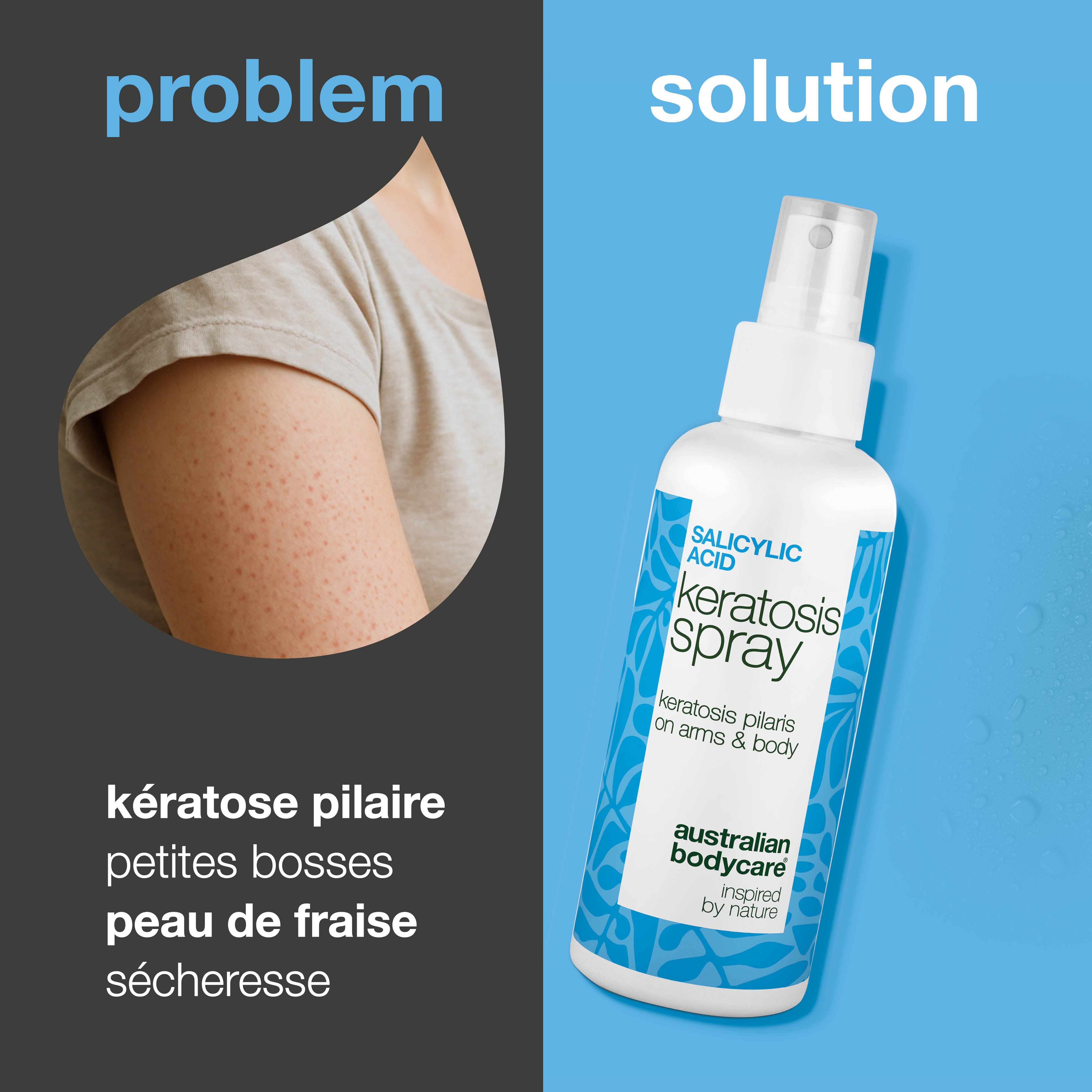 Bras avec imperfections cutanées. À côté, spray: Keratosis Spray, Australian Bodycare. Texte: Problème, solution.