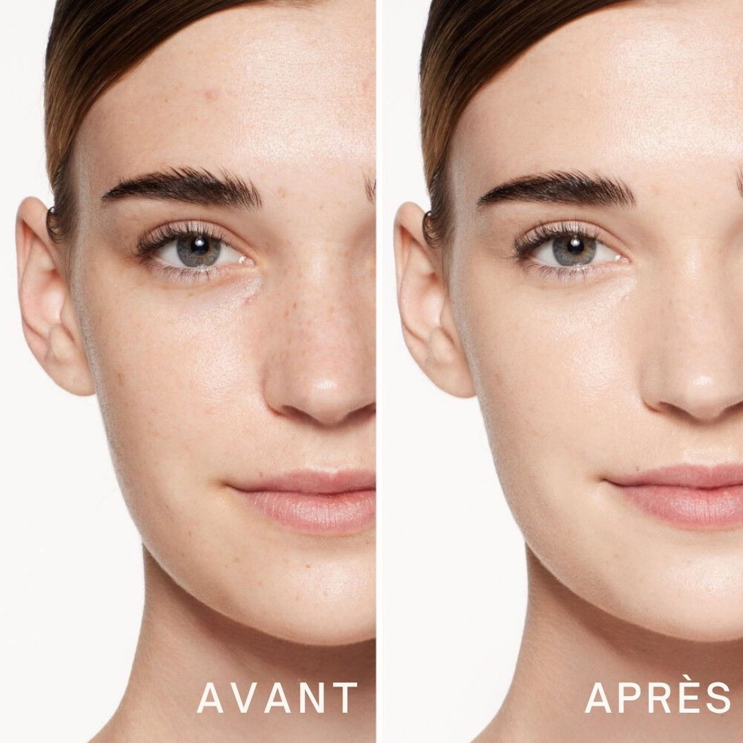 Comparaison avant-après. Les moitiés de visage montrent la peau avant et après. Amélioration notable.