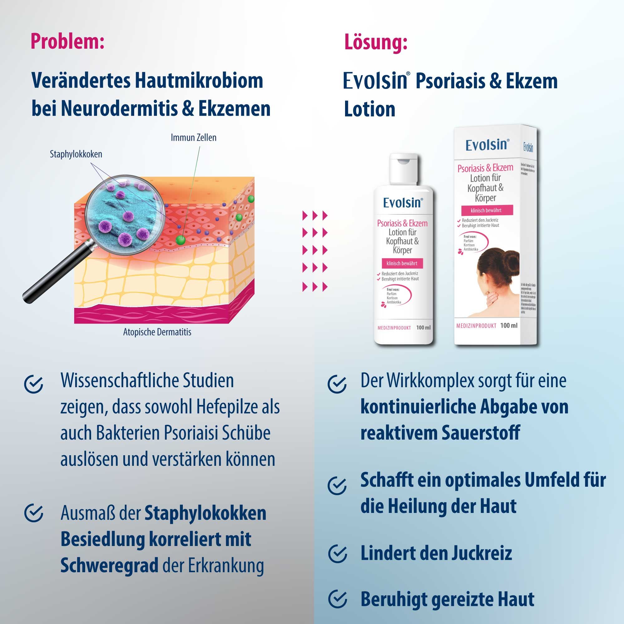 Graphique: Couches de peau avec agrandissement. Texte: Evolsin Psoriasis & Ekzem Lotion. Solution pour eczéma. Soulage les démangeaisons, apaise.