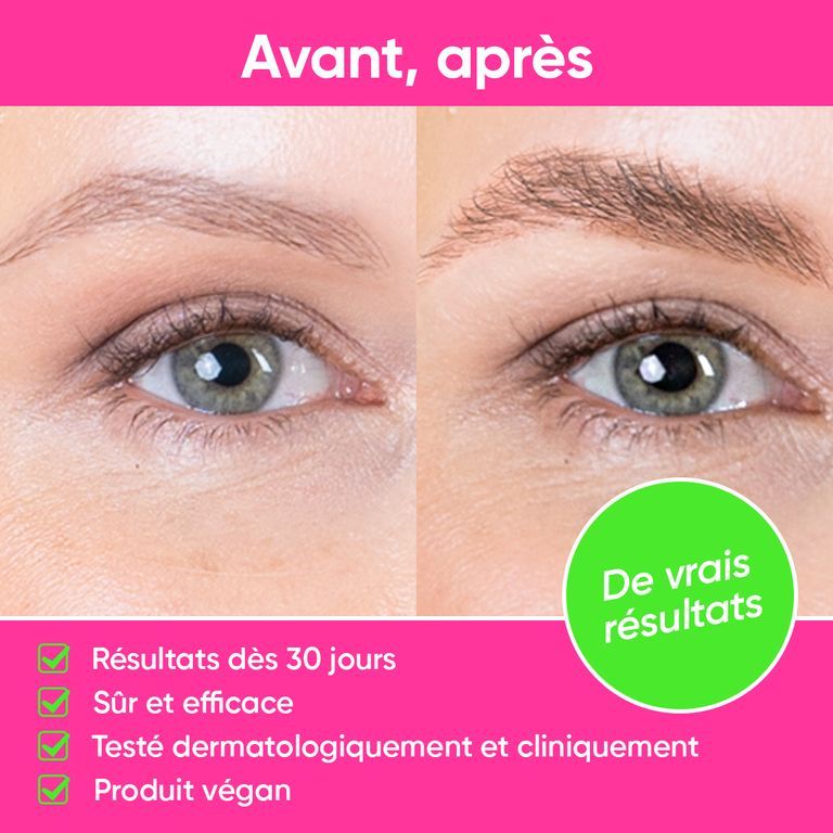 Comparaison avant-après de sourcils traités avec le sérum LUXE BROW. Résultats en 30 jours, sûr, efficace, végétalien.