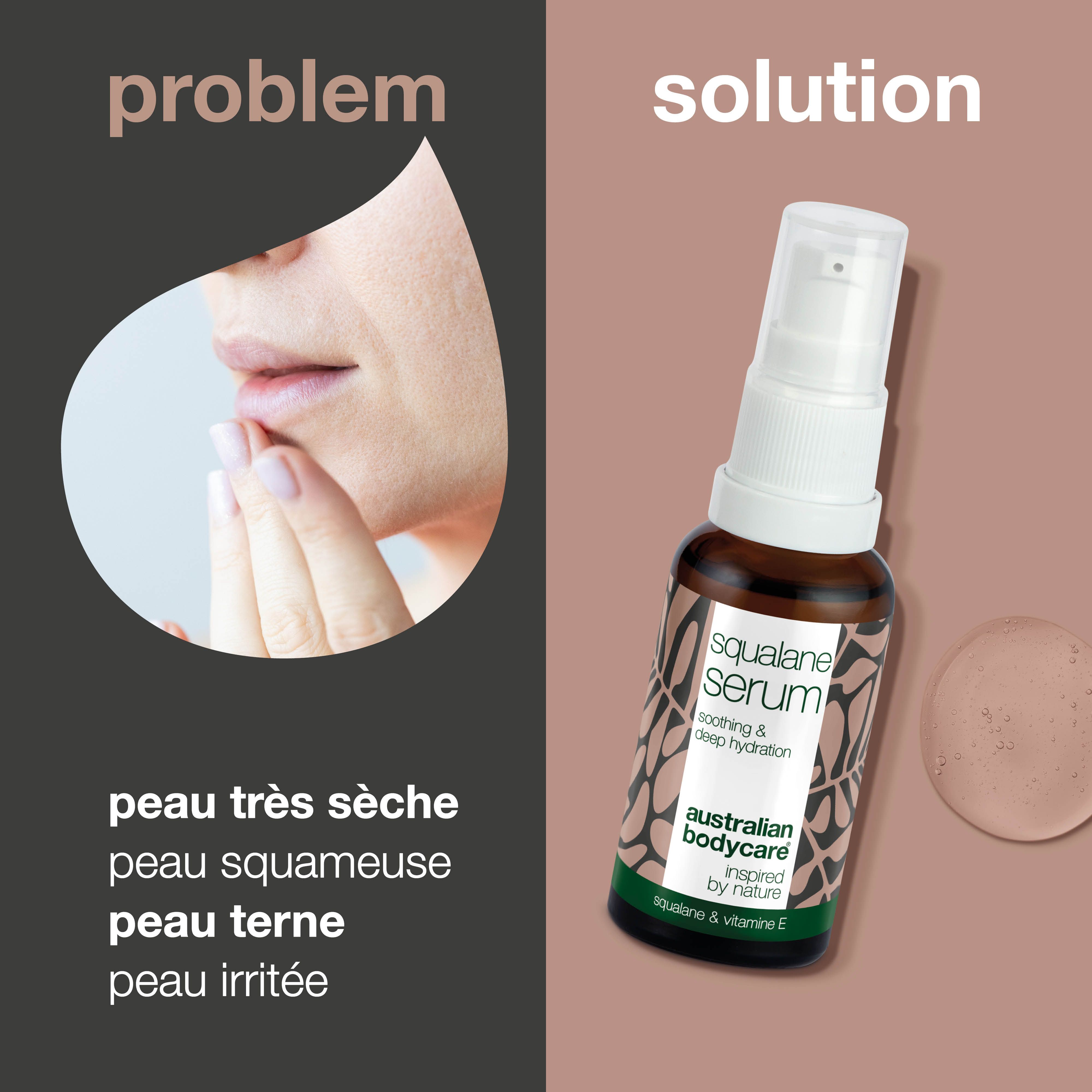 Flacon de sérum à côté d'un visage. Texte : peau très sèche, peau squameuse, peau terne, peau irritée. Squalane Serum.
