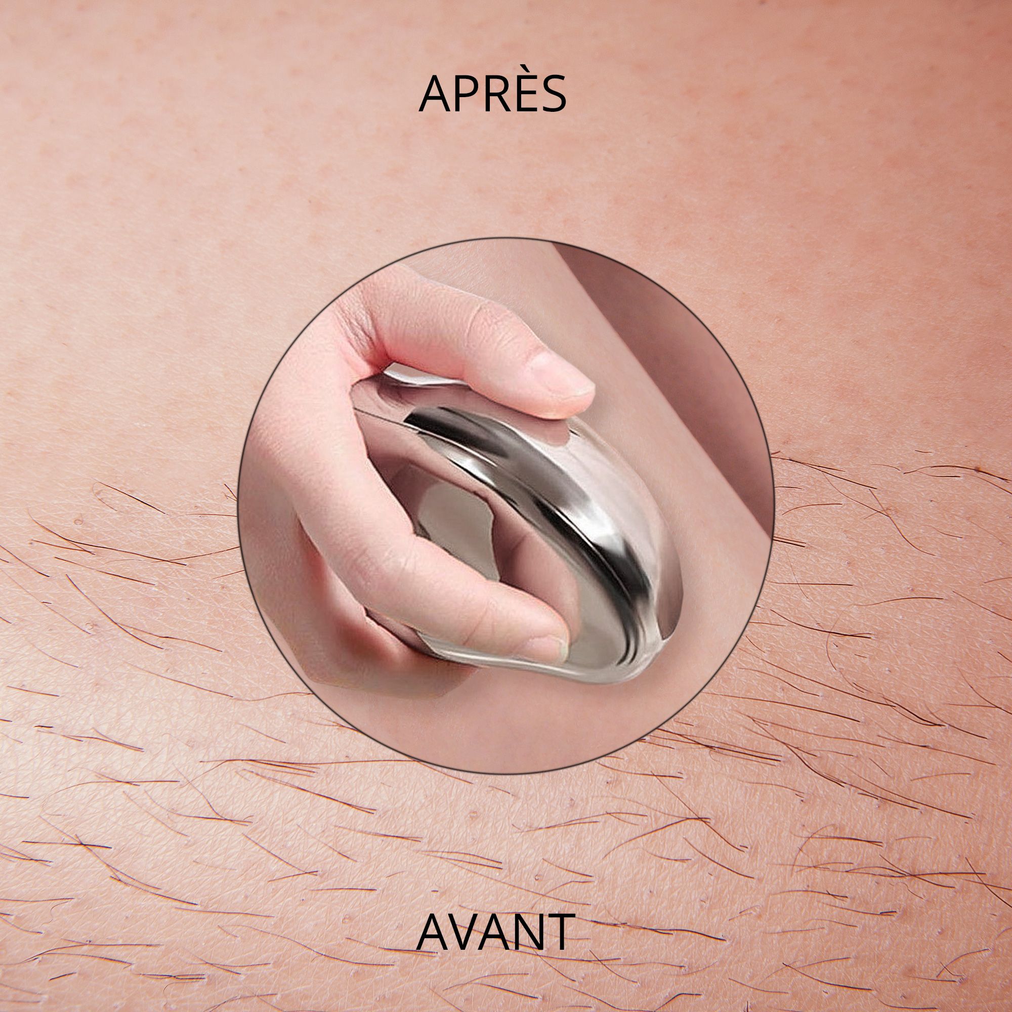 Gros plan d'une main utilisant un appareil argenté sur la peau. Inscriptions: AVANT et APRÈS.