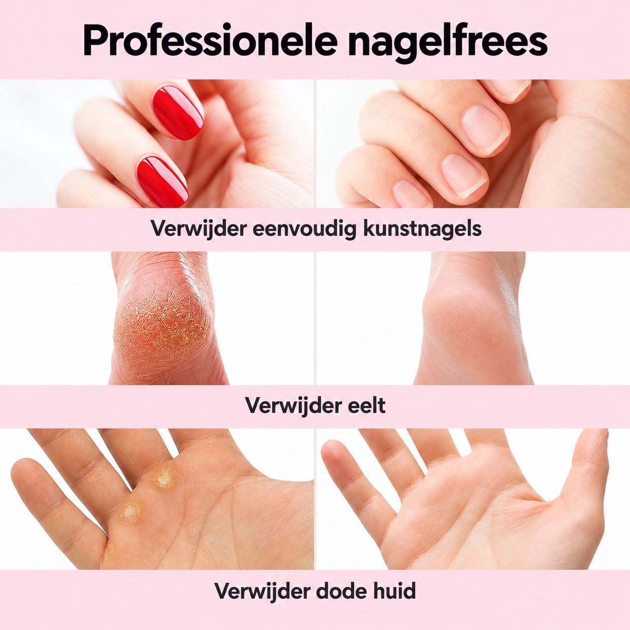 Voor-en-na-afbeeldingen: verwijderen van kunstnagels, eelt en dode huid.