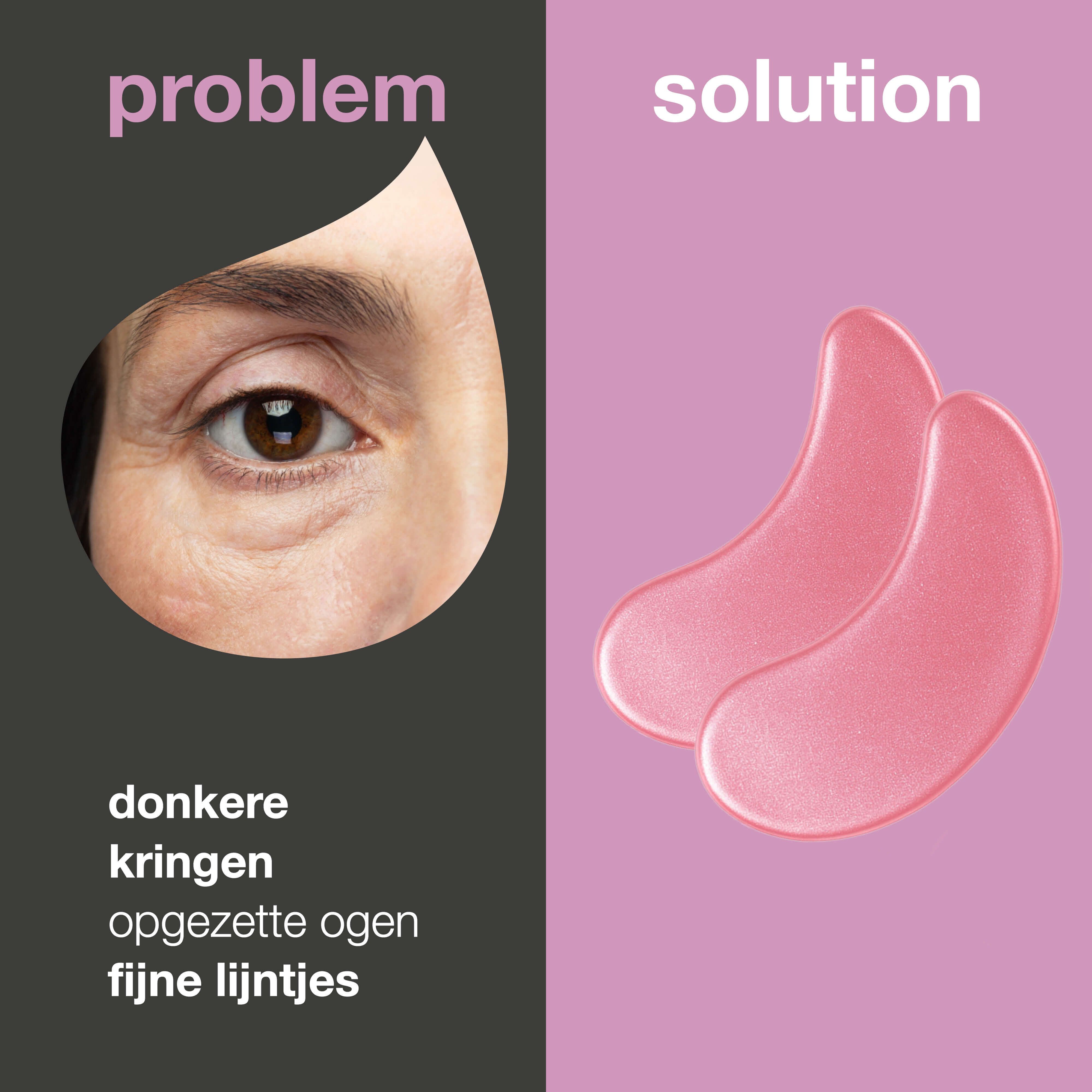 Vergelijking van oogcontour met donkere kringen en oogmaskers. Opschrift: Probleem, Oplossing. Roze oogmaskers.
