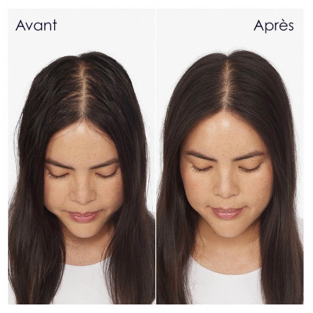 Comparaison avant-après. Femme aux cheveux foncés. Gauche : Avant. Droite : Après.