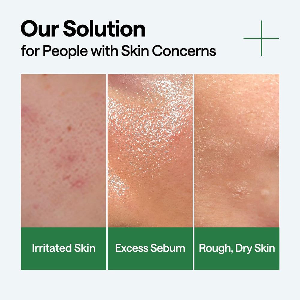Trois images de peau : peau irritée, excès de sébum, peau rugueuse et sèche. Texte : Our Solution for People with Skin Concerns.