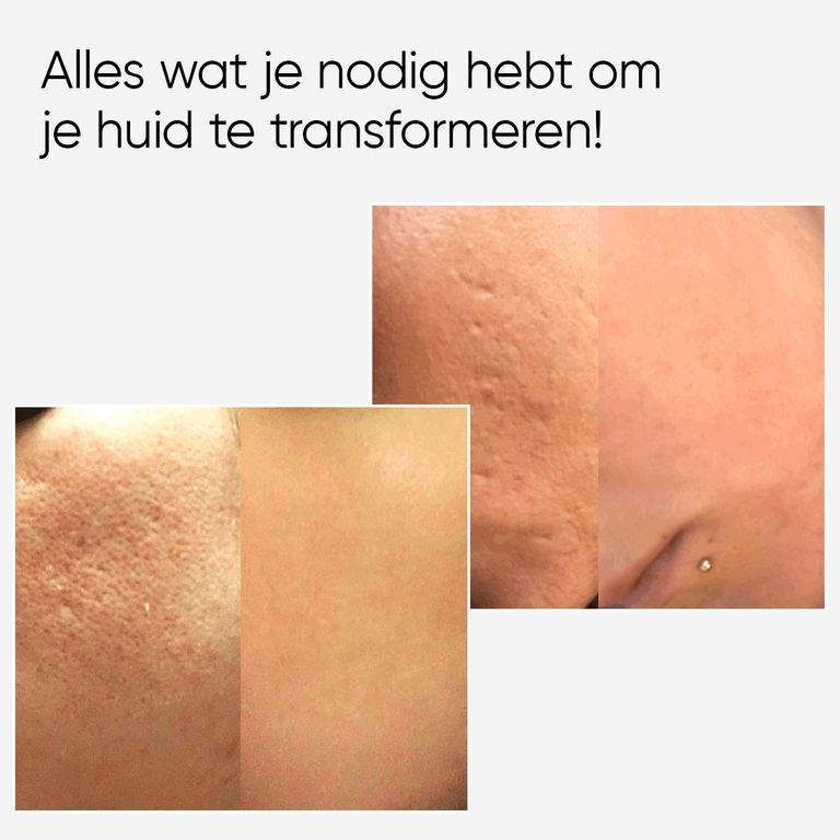 Vrouw van middelbare leeftijd gebruikt CIT Face Roller op gezicht. Tekst over collageenproductie.