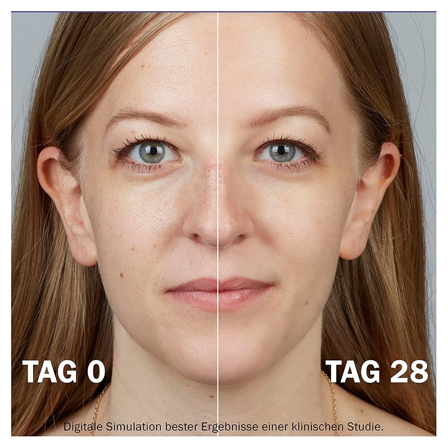 Visage de femme divisé. Gauche: Jour 0. Droite: Jour 28. Texte: Simulation numérique des meilleurs résultats.