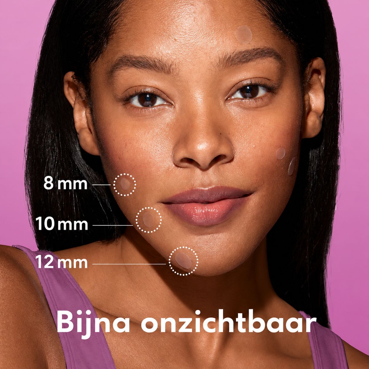 Drie bijna onzichtbare acne patches van 8 mm, 10 mm en 12 mm op het gezicht van een vrouw.