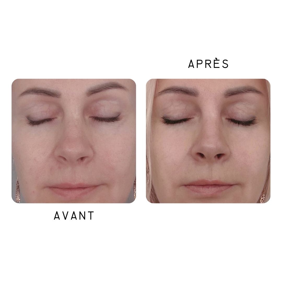 SEAMANTIKA - Peeling Gel Papaye