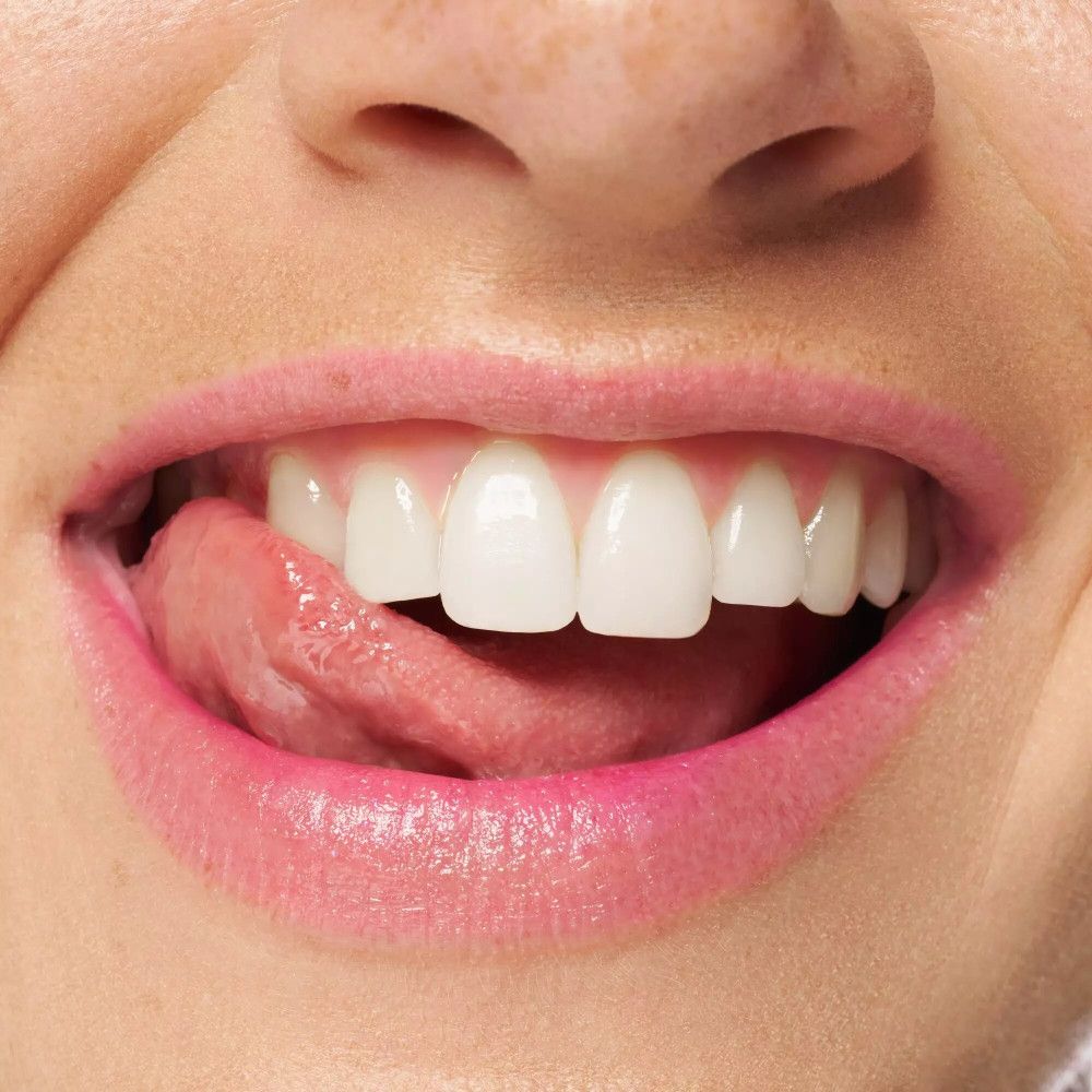 Gros plan sur une bouche avec des lèvres roses et des dents. La langue est partiellement visible.