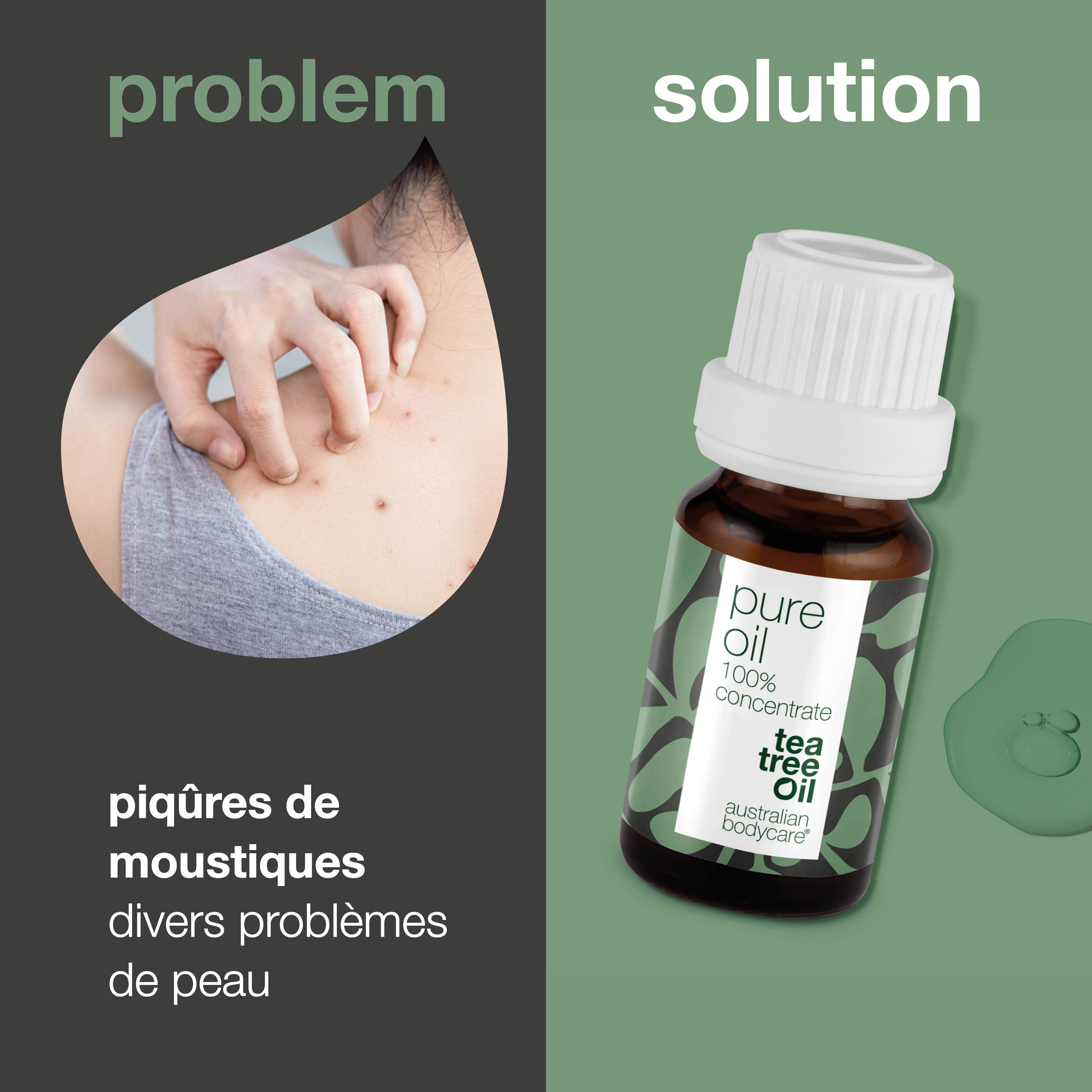 Graphique: problème et solution. Personne avec éruption cutanée, à côté flacon avec texte: pure oil, 100% concentrate, tea tree oil.