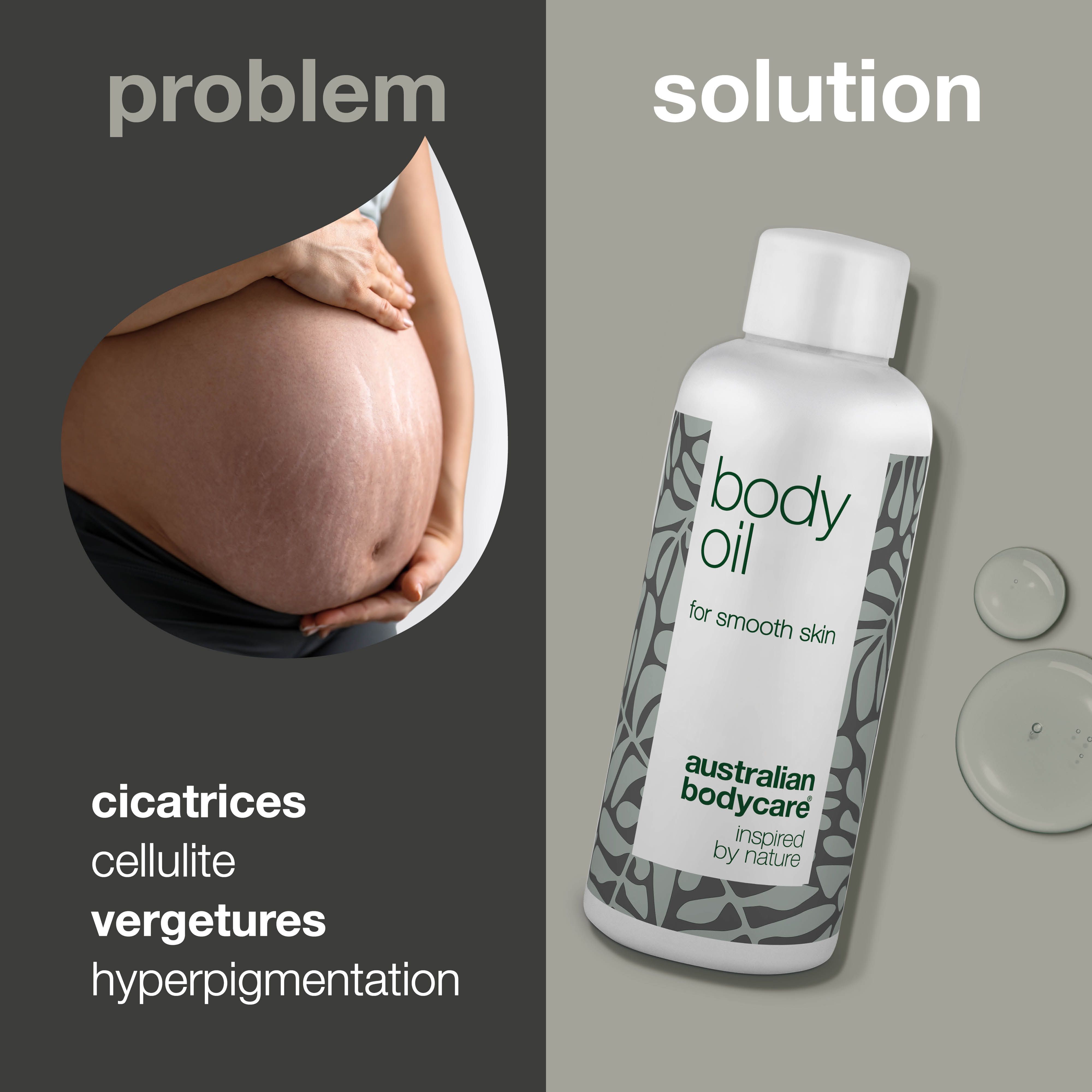 Ventre de femme enceinte avec vergetures. À côté, flacon avec « body oil ». Texte : cicatrices, cellulite, vergetures.