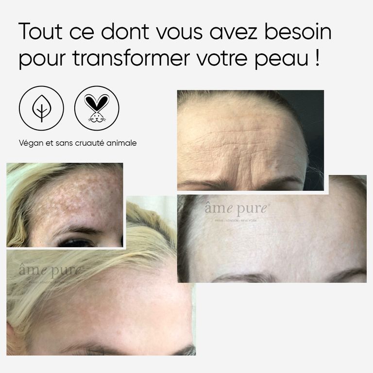 Images avant-après d'amélioration de la peau avec WrinklEraser.