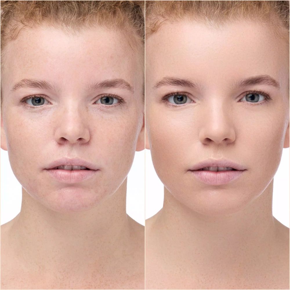 Comparaison avant-après. Femme avec imperfections, puis avec teint uniforme.